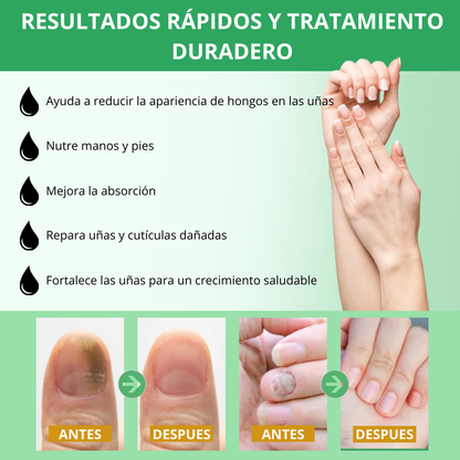 VitalUñas-Tratamiento de uñas 7 días