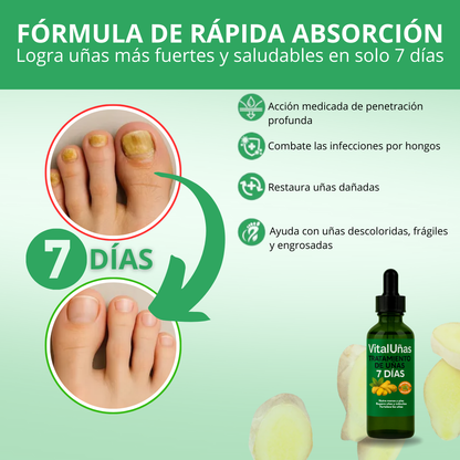VitalUñas-Tratamiento de uñas 7 días