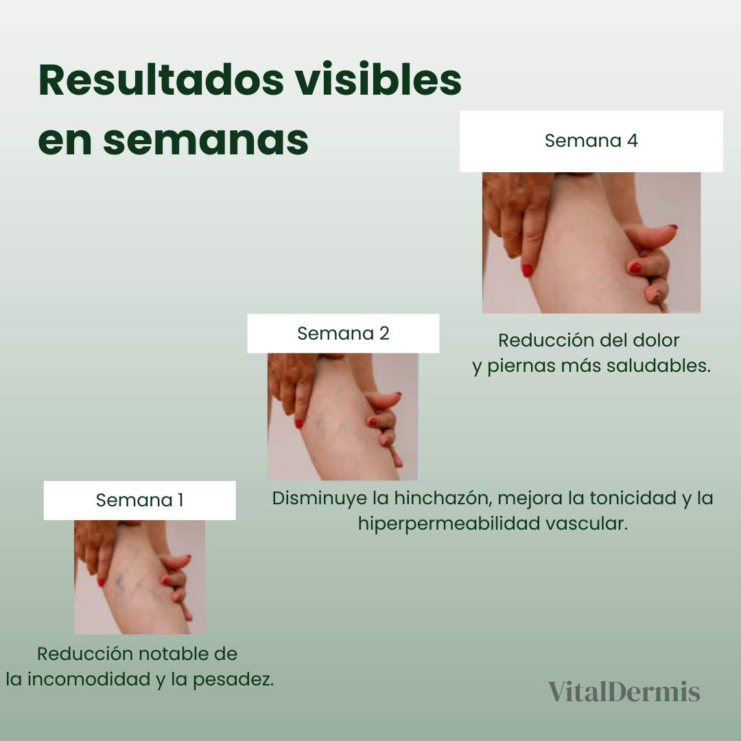 VitalVarices-Solución natural para el tratamiento de varices y arañas vasculares