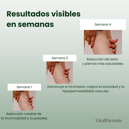 VitalVarices-Solución natural para el tratamiento de varices y arañas vasculares