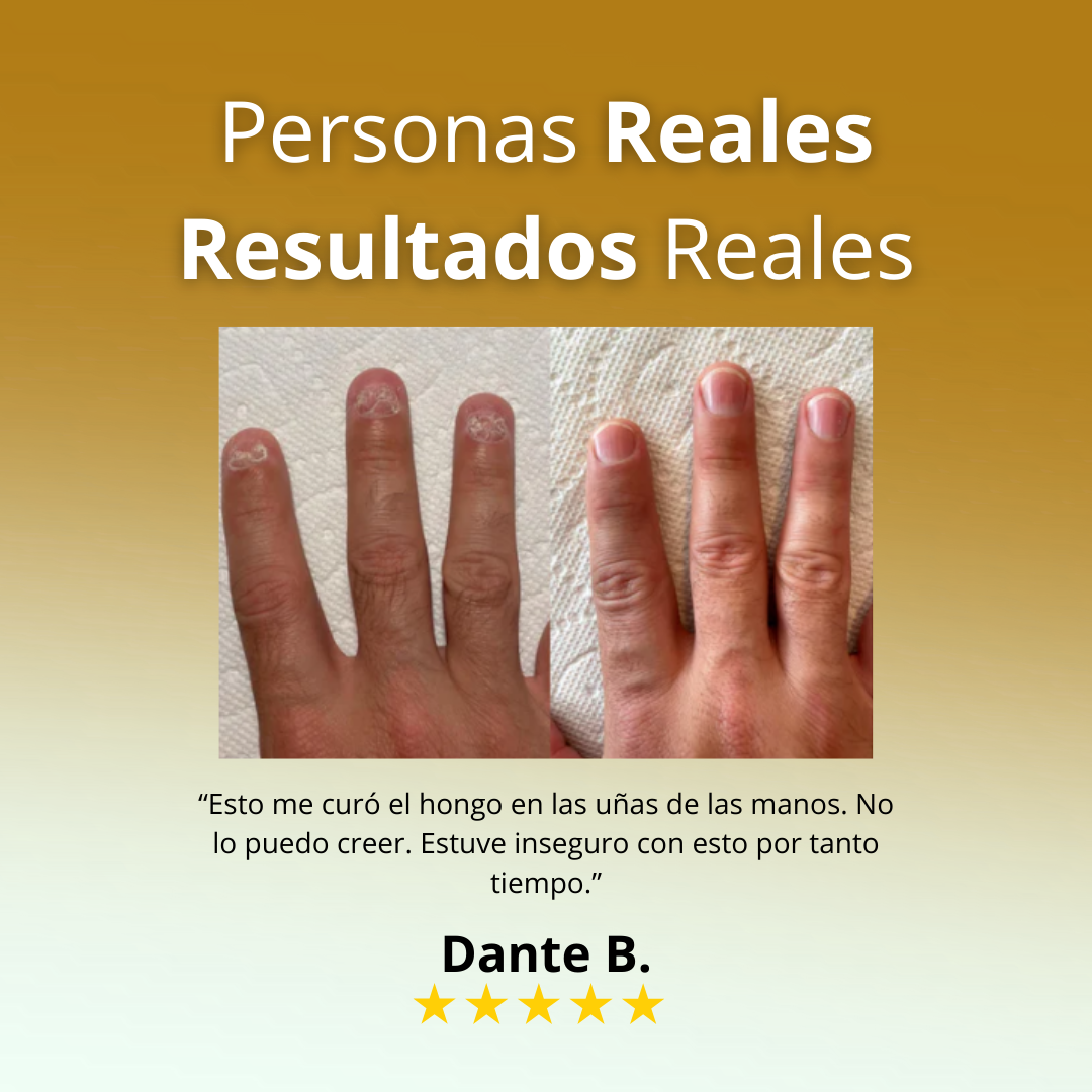 VitalUñas-Tratamiento de uñas 7 días