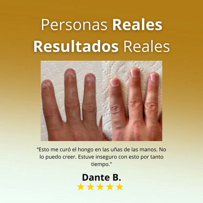 VitalUñas-Tratamiento de uñas 7 días