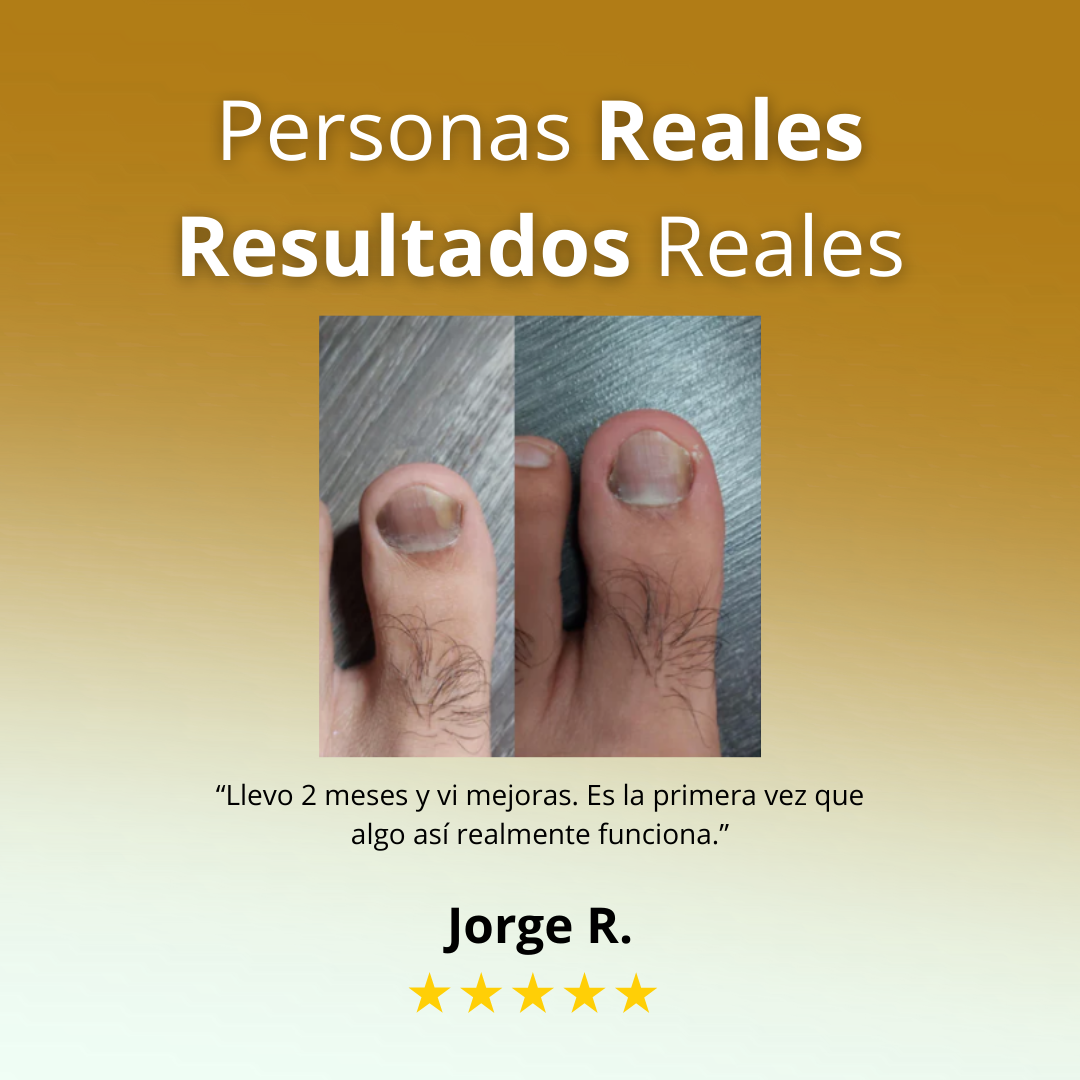 VitalUñas-Tratamiento de uñas 7 días