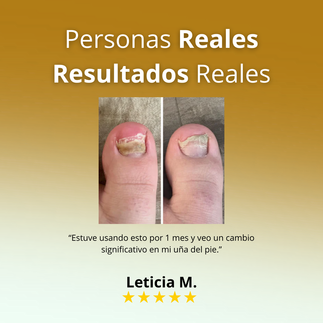 VitalUñas-Tratamiento de uñas 7 días